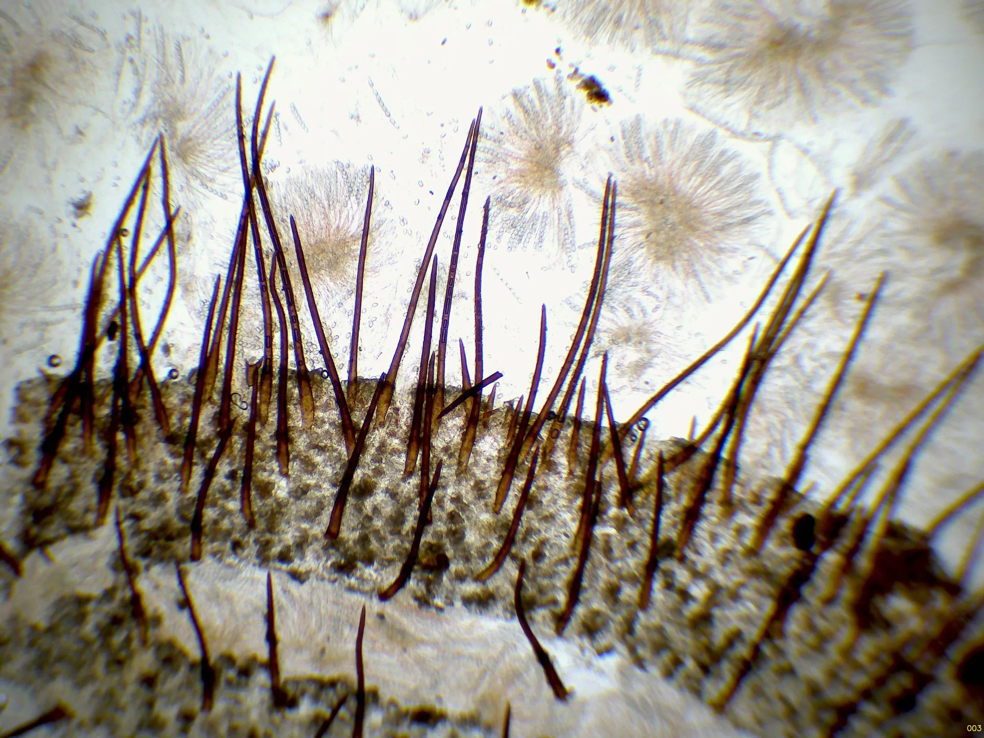 Microscopía de Scutellinia jungneri - 10 - Pelos x 40-003